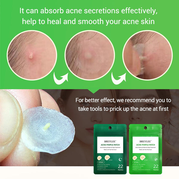 Plaster til Acne Behandling